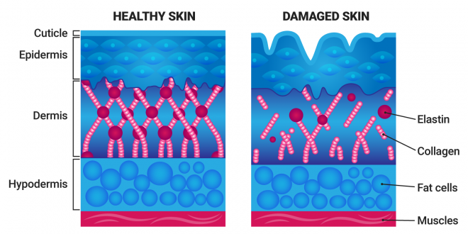 healthy skin vs damaged skin diagram